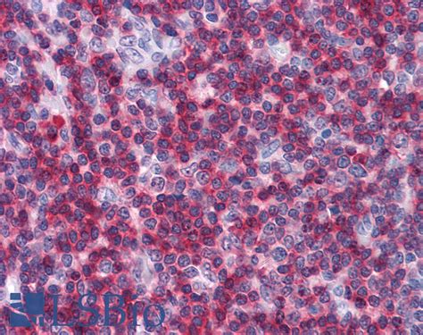 IHC Plus CD247 CD3 Zeta Monoclonal Antibody Mouse Anti Human LSBio