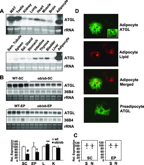 Expression pattern of ATGL transcript and localization of ATGL protein ...