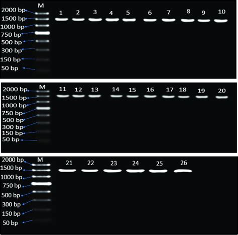 Full Length 16s Rrna Gene 1500bp Amplicons Of Bacillus Isolates