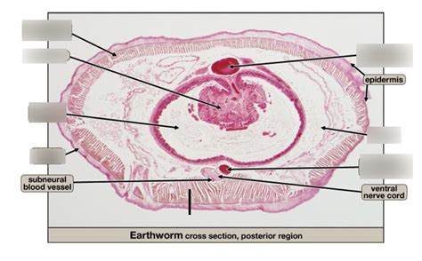 earthworm cross section (org: Lumbricus terrestris) Diagram | Quizlet