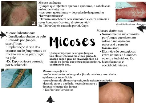 Mapas Mentais Sobre Micoses Study Maps Porn Sex Picture