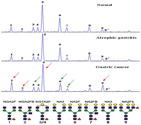 A Typical Desialylated N Glycan Profile Of Serum Protein At Least 9