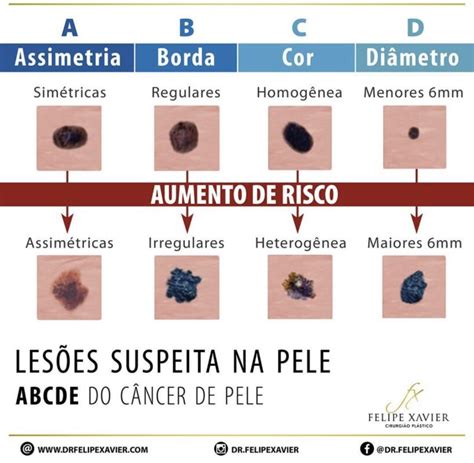 Quais São Os Tipos De Lesão Medulares LIBRAIN