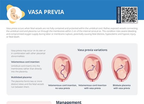 Vasa Previa [+ Free Cheat Sheet] | Lecturio Nursing