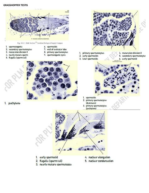 Solution Spermatogenesis Under Microscopre Grasshopper Testis Frog