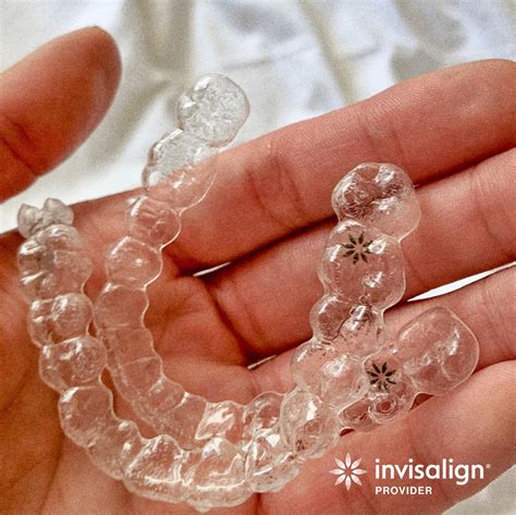 My Invisalign Aligners Are Cutting My Gums What Can I Do King