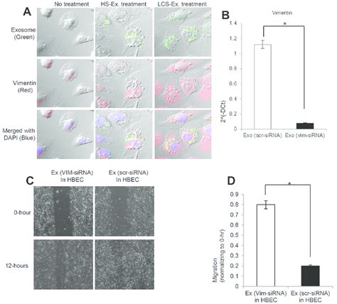 Vimentin Induced By Exosomes Is Necessary For Human Lung Cancer To