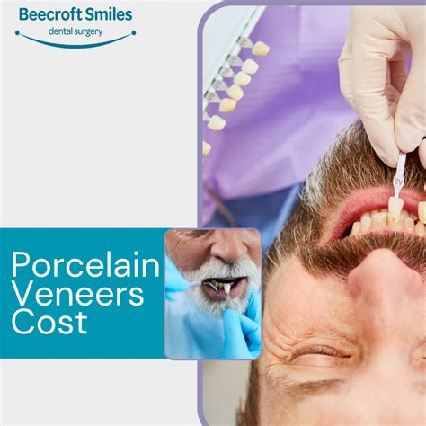 How Much Do Porcelain Veneers Cost A Detailed Breakdown