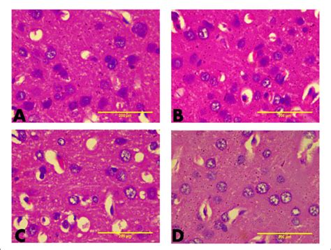 Representative Photomicrographs Of The Histoarchitecture Of The Pfc