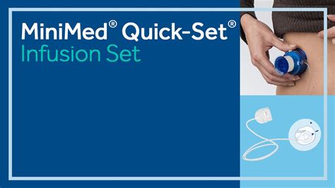 Minimed Quick Set Infusion Set Youtube