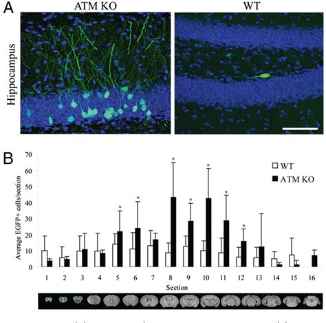 Figure 1 From Ataxia Telangiectasia Mutated ATM Modulates Long