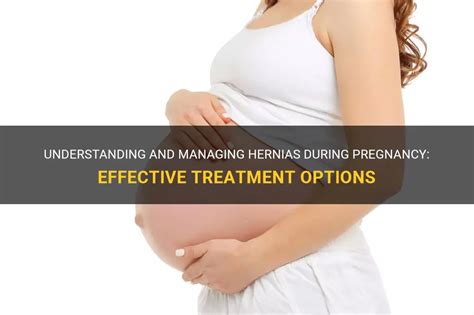 Understanding And Managing Hernias During Pregnancy Effective