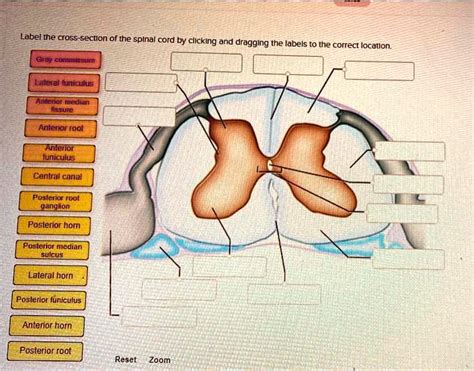 Label The Cross Section Of The Spinal Cord By Clicking And Dragging The