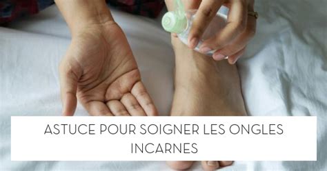 Astuce pour soigner les ongles incarnés Le blog StarOfService