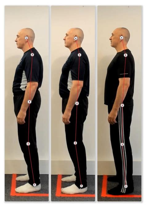 Posture Correction Done Right Chiropractor Birmingham