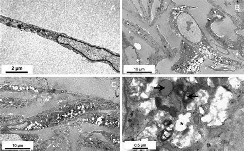 Transmission Electron Micrograph Of Normal Fibroblasts A In