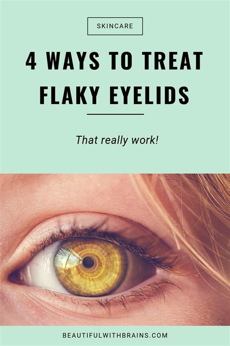 4 Ways To Treat Flaky Eyelids Dry Flaky Skin Dry Skin Around Eyes Dry Skin Eyes