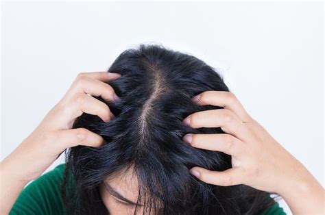 Crawling Sensation On Scalp Reasons And Treatments Ungex