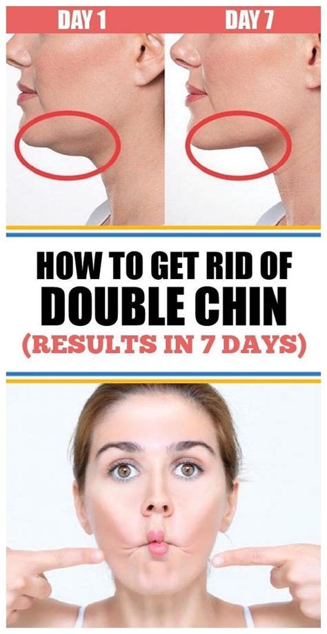 Get Rid Of Double Chin And Restore An Appealing Look In Chin