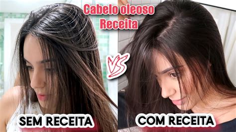 Receita CASEIRA Para ACABAR CABELO OLEOSO Ju Leme YouTube