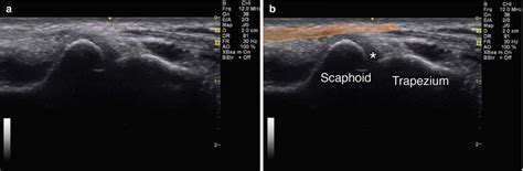 Wrist And Hand Radiology Key