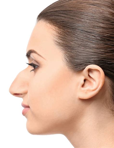 Augmentation Rhinoplasty Silicone Vs Cartilage Allure Plastic Surgery