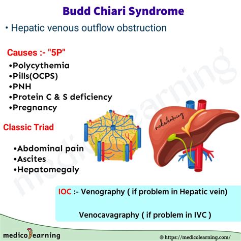 Budd Chiari Syndrome MedicoLearning