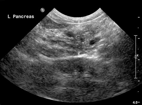 Acvim Consensus Statement On Pancreatitis In Cats Forman 2021