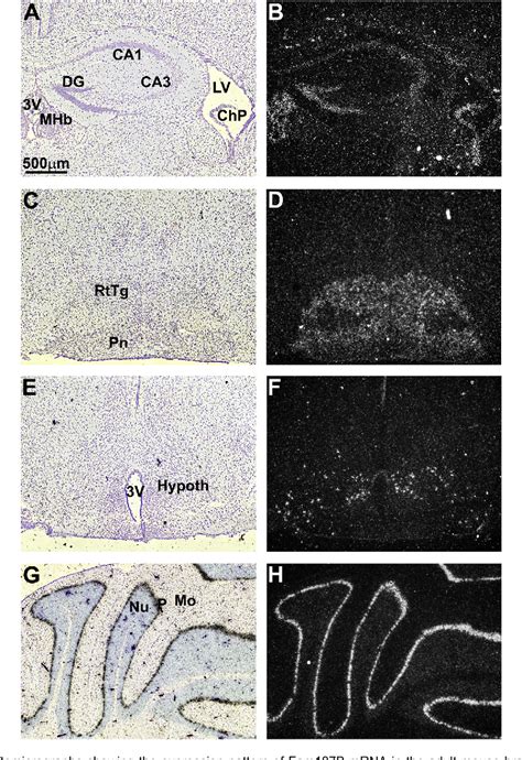 Figure From Deciphering The Spatio Temporal Expression And Stress