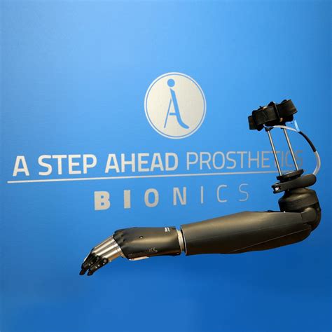 Osseointegration Arm Upper 3 A Step Ahead Prosthetics