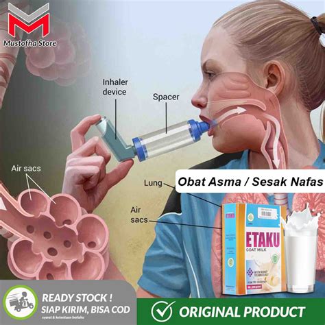 Obat Asma - Asma Inhaler - Asma Semprot - Sesak Nafas - Etaku Susu Kambing Etawa | Lazada Indonesia