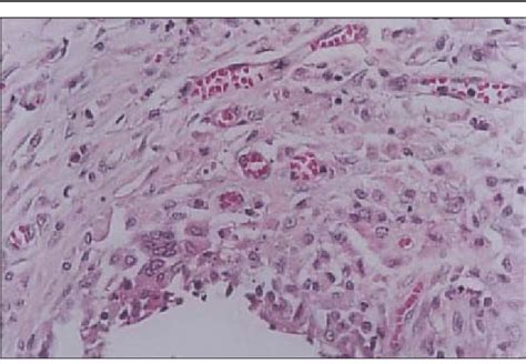 Corte Histol Gico De Parede Abdominal De Rato De Gm Aos Dias