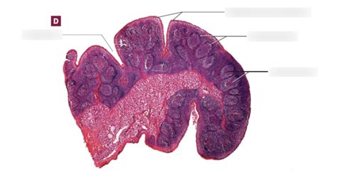 palatine tonsil Diagram | Quizlet