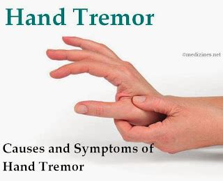 Hand Tremor Causes And Symptoms Of Hand Tremor