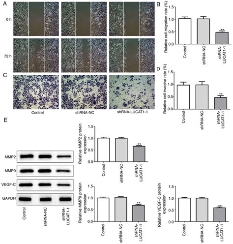 Inhibition Of Lucat1 Suppresses Cell Migration And Invasion A Cell