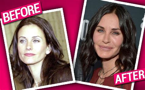 About Face! Courteney Cox 'Bit By The Surgery Bug'