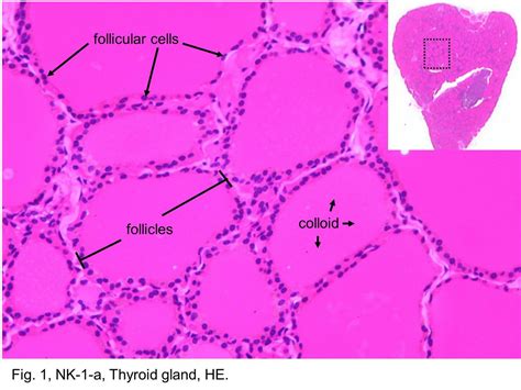 Follicular Colloid Of Thyroid