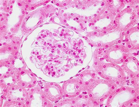 Kidney Glomerulus Light Micrograph Stock Image C0576788 Science