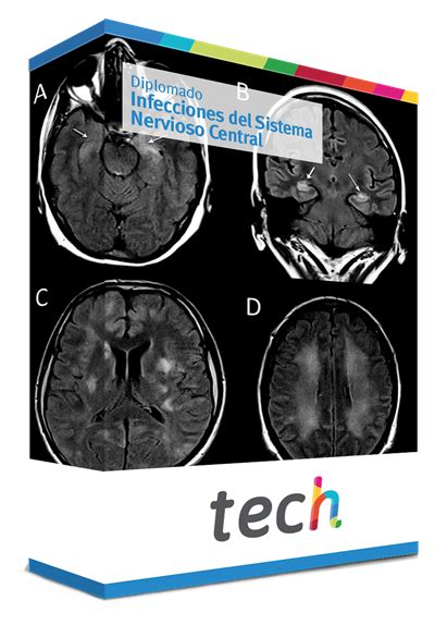 Sistema Nervioso Central Infecciones Del Sistema Nervioso Central The