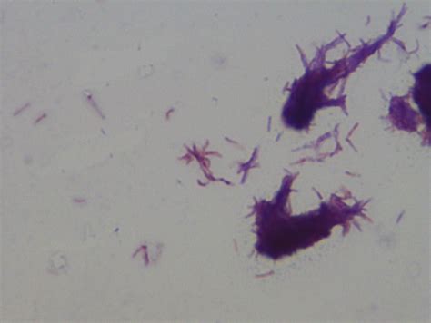 Mycobacterium Smegmatis Gram Stain