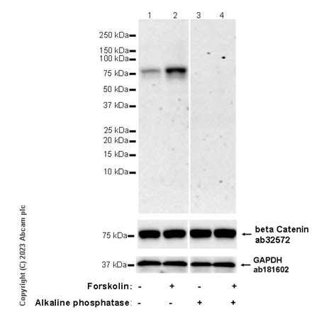 Beta Catenin重组抗体 Epr28410 45 Beta Catenin抗体ab314450