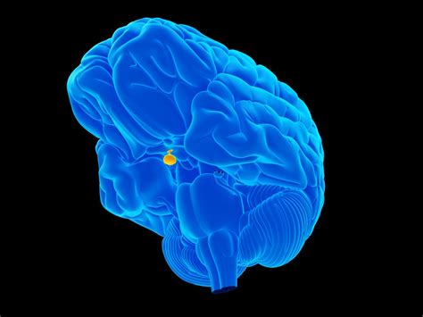 Cushing's Disease Precise Tumor Location Spotted by Stronger MRI