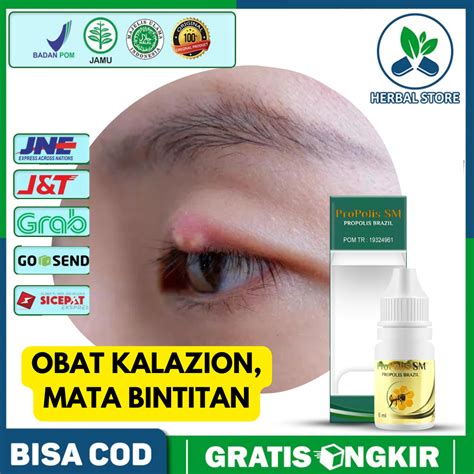 Jual Obat Mata Kalazion Mata Bengkak Bintitan Benjolan Di Kelopak