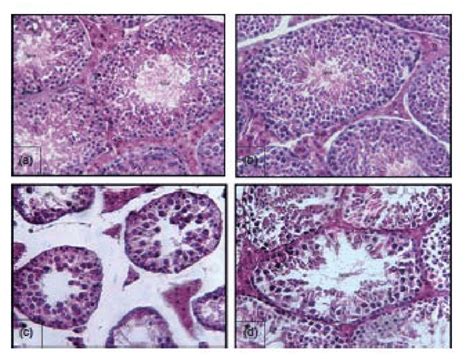 Figure A2 A Testicular Sections Of Control Mice Which Show Normal