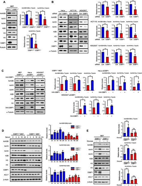 53BP1 Regulates Global Histone Acetylation A Total Cell Extracts