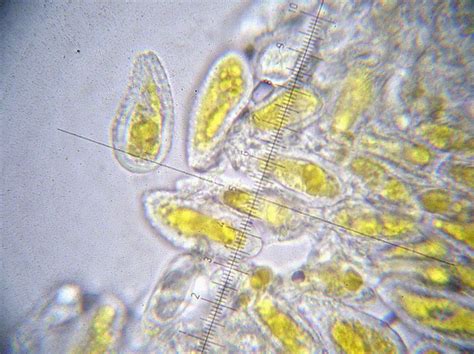 Melampsora Allii Fragilis Obligat Phytoparasitische Kleinpilze