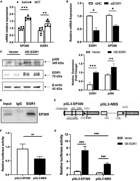 Frontiers The Protective Role Of EP300 In Monocrotaline Induced