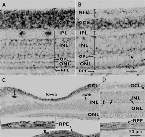 In Situ Hybridization For Pedf Mrna Dark Reaction Product In Fetal