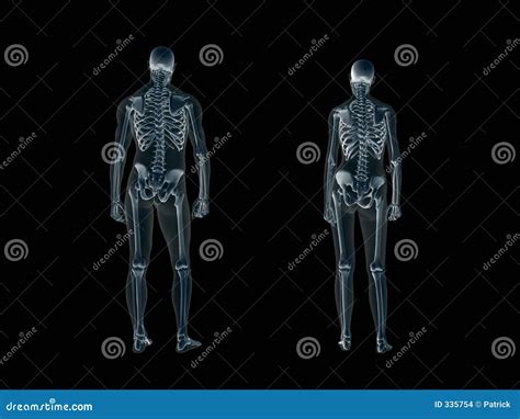 Xray X Ray Of The Human Body Man And Woman Stock Illustration Illustration Of People