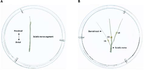 Sciatic Nerve And Sciatic Dorsal Roots Dissection A And B Dissected